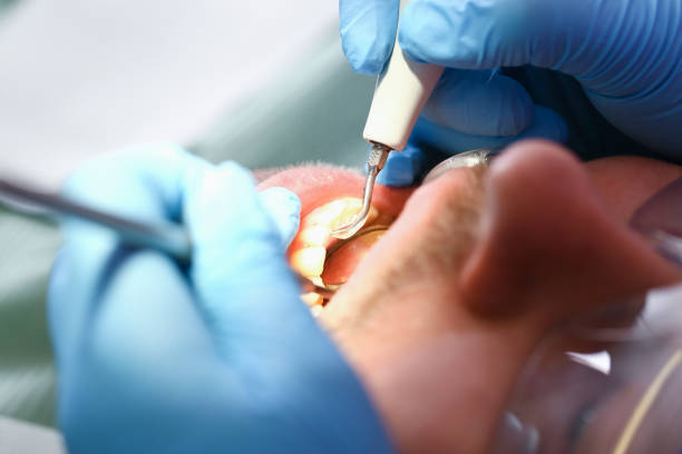 Best Emergency Denture Repair in Elim, PA